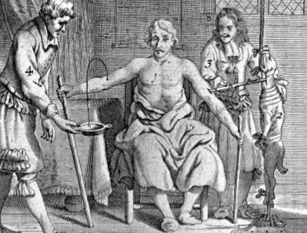 血色黎明:古代西方手术为何深陷放血迷雾